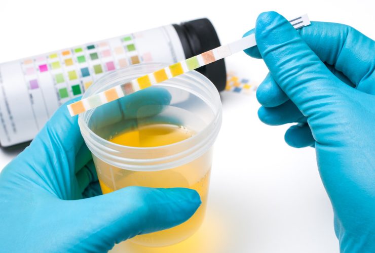 Tes urine massal anggota Polres Tangerang Selatan sebagai komitmen memberantas narkoba di internal kepolisian